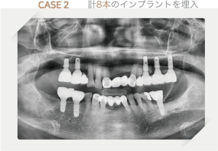 CASE2