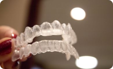 ホームホワイトニング剤のマウスピース作成